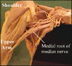 shoulder and upper arm diagram